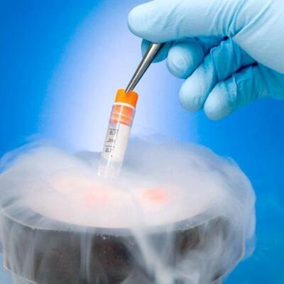 Криоконсервация эмбрионов с хранением 1 месяц (до 3 криотопов)